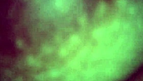 tetas cargadas de leche