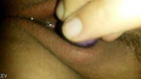 anal bleaching clareamento anallicia