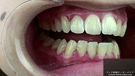 Teeth Fetish Exploration with Unique Saliva Play Today