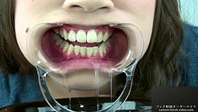 Teeth Fetish Exploration with Unique Saliva Play Today