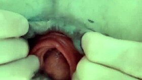 استكشاف البرولابس بشرجي مزدوج