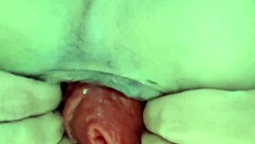 双性恋肛门扩张探索我的脱肛！