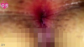 Asian Ass Widened For Anal.