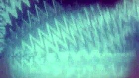 Outdoor blowjobs in public places during 2020