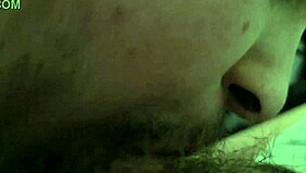 i received oral attention