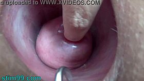 Extreme cervix electrosex penetrates deep into womb