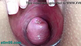 Extreme cervix electrosex penetrates deep into womb