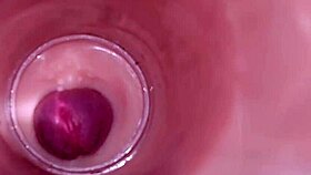 Female insemination internal camera captures deep male ejaculation