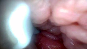 Penis Sensitivity Exposed Emotionally