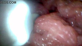 Penis Sensitivity Exposed Emotionally