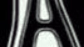 Latina Star Alemán Rocks BZRP Music Sessions Episode 15