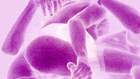 Explore timeless allure of vintage erotic artwork masterpieces.