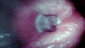 endoscope views huge cock cumshot explosion deep inside