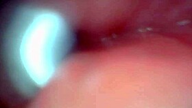 endoscope views huge cock cumshot explosion deep inside